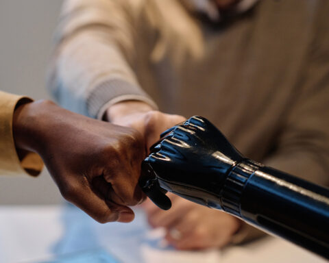 mind-controlled-prosthetic-hand-revolutionizes-limb-replacement